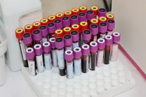 Why Normal HbA1c Can Hide Metabolic Stress