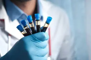 Why Standard Lipid Panels Miss Early Disease