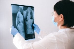 AI Muscle Scans Predict Heart Valve Surgery Survival