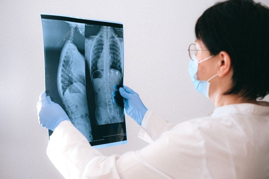 Radiologist reviewing an X-ray scan image