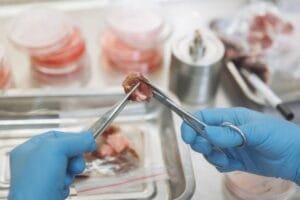 Scientists Want to Build Tiny Muscle ‘Organs’ to Predict Who Recovers From Age-Related Weakness